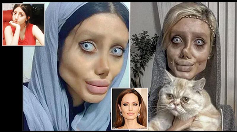Fan underwent surgery to look like Angelina Jolie